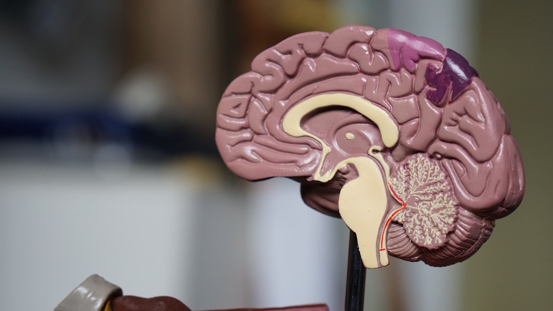 Advancements in Brain Tumor Treatment at Newton-Wellesley Hospital Photo brain tumors
